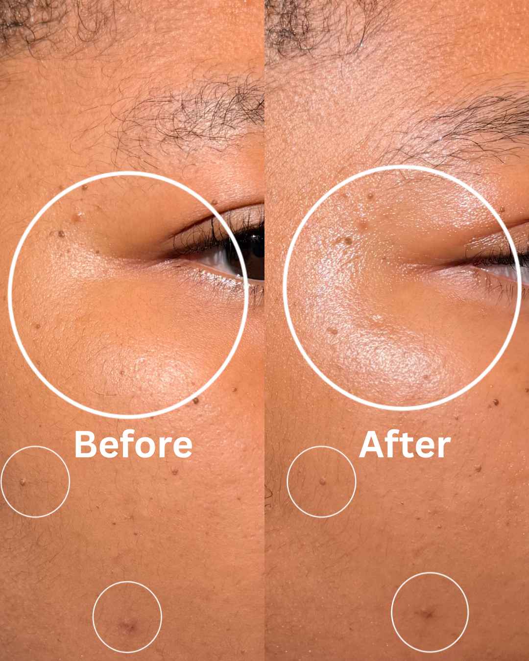 Before and after close-up of under-eye skin texture showing visible improvement in smoothness and tone after using Hat Trick Serum