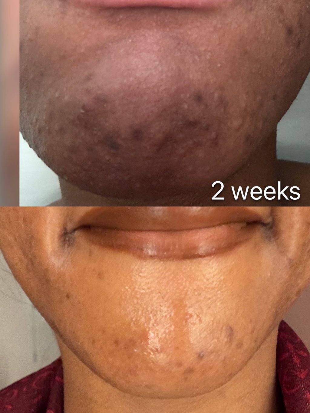 Step 3 - RESET : Skin Tone Correcting Serum