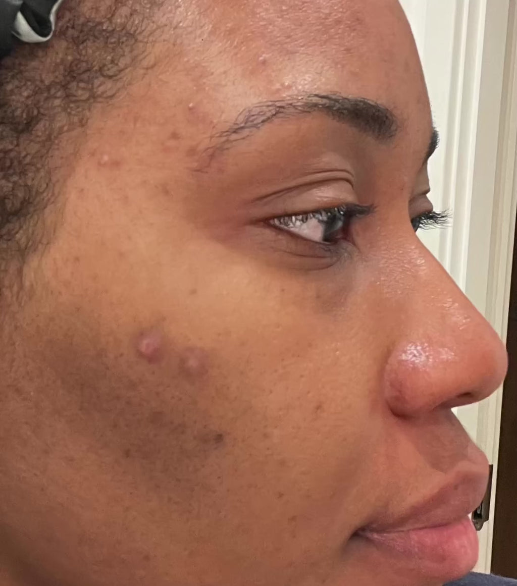 Step 3 - RESET : Skin Tone Correcting Serum